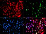 RAP80 Antibody in Immunocytochemistry (ICC/IF)