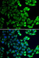 RAP80 Antibody in Immunocytochemistry (ICC/IF)