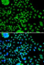 ATOH7 Antibody in Immunocytochemistry (ICC/IF)