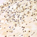 BCAS3 Antibody in Immunohistochemistry (Paraffin) (IHC (P))