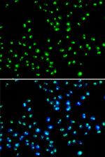 NAT10 Antibody in Immunocytochemistry (ICC/IF)