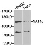 NAT10 Antibody in Western Blot (WB)