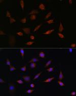 PDCD5 Antibody in Immunocytochemistry (ICC/IF)