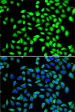 SGTA Antibody in Immunocytochemistry (ICC/IF)