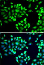 SGTA Antibody in Immunocytochemistry (ICC/IF)