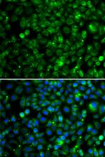 TMLHE Antibody in Immunocytochemistry (ICC/IF)