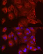 WISP2 Antibody in Immunocytochemistry (ICC/IF)