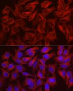 WISP2 Antibody in Immunocytochemistry (ICC/IF)