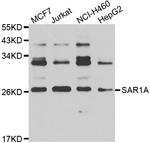 SAR1A Antibody in Western Blot (WB)