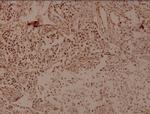 THOC5 Antibody in Immunohistochemistry (Paraffin) (IHC (P))