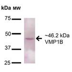 VMP1 Antibody in Western Blot (WB)