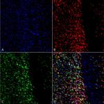 Phospho-alpha Synuclein (Ser129) Antibody in Immunocytochemistry (ICC/IF)