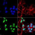 ChAT Antibody in Immunocytochemistry (ICC/IF)