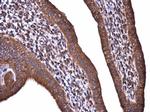 Acetyl-CoA Carboxylase Antibody in Immunohistochemistry (Paraffin) (IHC (P))