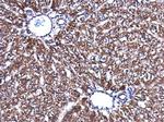 Acetyl-CoA Carboxylase Antibody in Immunohistochemistry (Paraffin) (IHC (P))