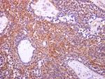 Aconitase 1 Antibody in Immunohistochemistry (Paraffin) (IHC (P))