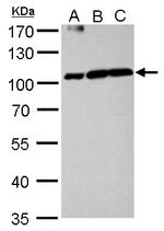 Aconitase 1 Antibody in Western Blot (WB)