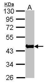 Skeletal Muscle Actin Antibody in Western Blot (WB)