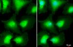 AKT Pan Antibody in Immunocytochemistry (ICC/IF)