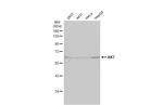 AKT Pan Antibody in Western Blot (WB)