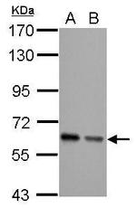 AKT Pan Antibody in Western Blot (WB)