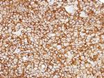 CD13 Antibody in Immunohistochemistry (Paraffin) (IHC (P))