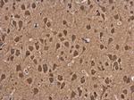 ASCL1 Antibody in Immunohistochemistry (Paraffin) (IHC (P))