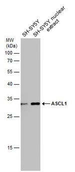 ASCL1 Antibody in Western Blot (WB)