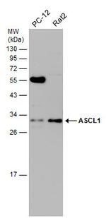 ASCL1 Antibody in Western Blot (WB)