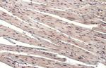 Phospho-ATR (Thr1989) Antibody in Immunohistochemistry (Paraffin) (IHC (P))