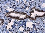 Phospho-ATR (Thr1989) Antibody in Immunohistochemistry (Paraffin) (IHC (P))