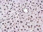 Phospho-ATR (Thr1989) Antibody in Immunohistochemistry (Paraffin) (IHC (P))