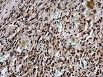 Phospho-ATR (Thr1989) Antibody in Immunohistochemistry (Paraffin) (IHC (P))