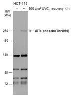 Phospho-ATR (Thr1989) Antibody in Western Blot (WB)