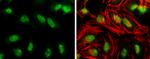 Phospho-ATR (Thr1989) Antibody in Immunocytochemistry (ICC/IF)