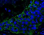 Axl Antibody in Immunohistochemistry (Paraffin) (IHC (P))