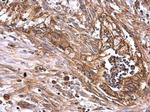 Axl Antibody in Immunohistochemistry (Paraffin) (IHC (P))