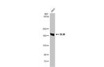 Blooms Syndrome Antibody in Western Blot (WB)