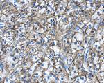 Carbonic Anhydrase IX Antibody in Immunohistochemistry (Paraffin) (IHC (P))