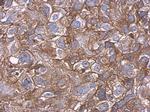 Carbonic Anhydrase IX Antibody in Immunohistochemistry (Paraffin) (IHC (P))