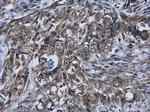 Cyclin D2 Antibody in Immunohistochemistry (Paraffin) (IHC (P))