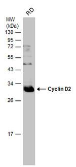 Cyclin D2 Antibody in Western Blot (WB)