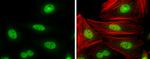 Cyclin T1 Antibody in Immunocytochemistry (ICC/IF)