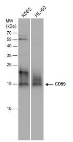 CD59 Antibody in Western Blot (WB)