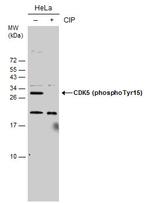 Phospho-CDK5 (Tyr15) Antibody in Western Blot (WB)