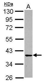 CDK6 Antibody in Western Blot (WB)