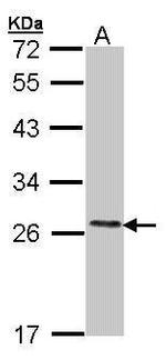 COMT Antibody in Western Blot (WB)