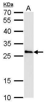 COMT Antibody in Western Blot (WB)