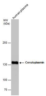 Ceruloplasmin Antibody in Western Blot (WB)