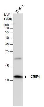 CRIP1 Antibody in Western Blot (WB)